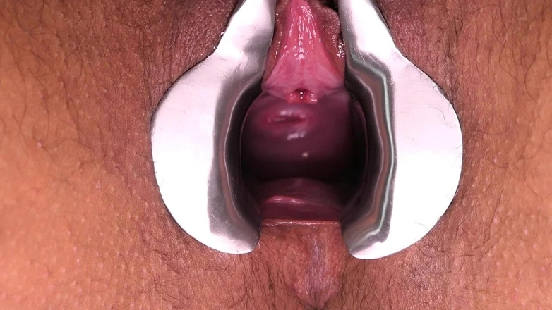 TripleXTransMan: Гинекологическое зеркало показывает мои внутреннсти