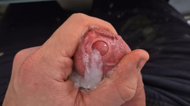 GloomyChase977: Big Uncut Daddy.. Tight Phimosis Foreskin Play, Precum Flood, and...