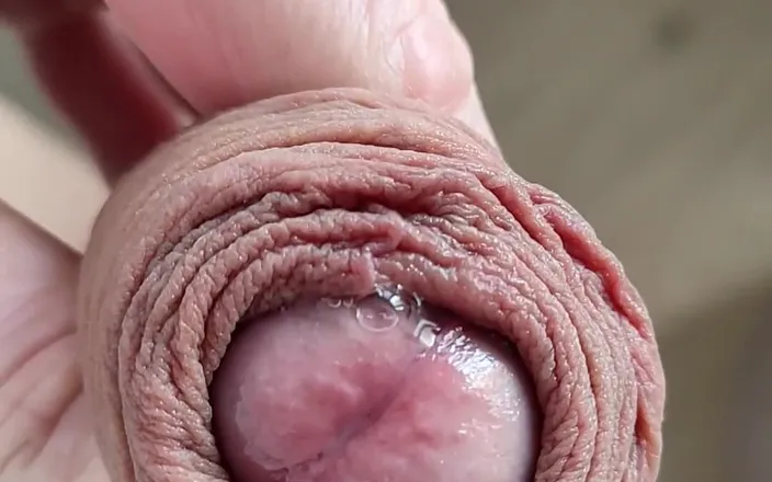 Medi Voi: I Need Your Mouth Very Quickly