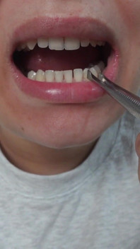 La mia sorellastra gigantessa gioca da dentista con il piccolo fratellastro,