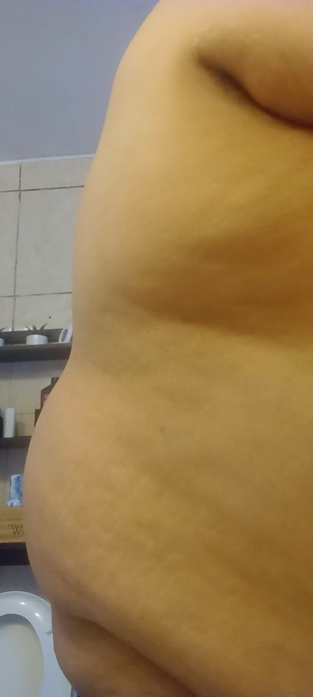 Who Wants These Tits (BouncyLove290)