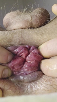 La mia piccola rosa ed il ditalino del mio culo