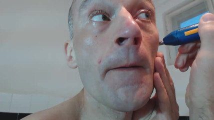 TIVADAR 73: Tivadar 73 threads removal.