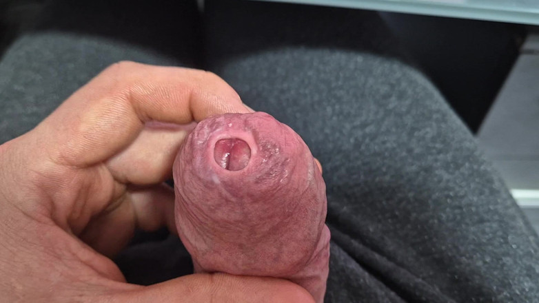 GloomyChase977: Uncut Tight Phimosis Cock Precum Tease for Foreskin Lovers with...
