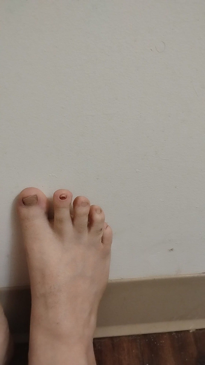 JG Risk: 11-26-2025 Roztomilé malé prsty