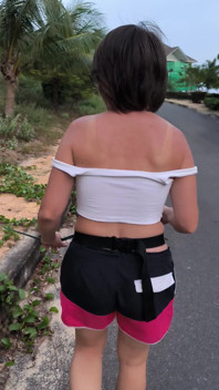 She Really Likes to Sunburn