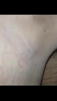 Axila 2