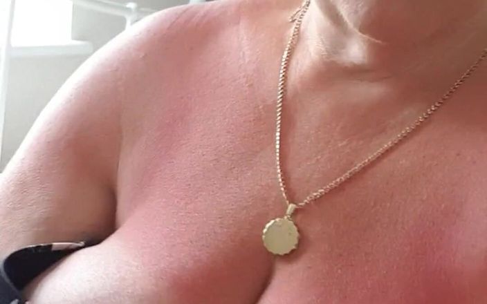 UK Joolz: ¡Tetas rojas por estar sentada al sol demasiado largo ayer!