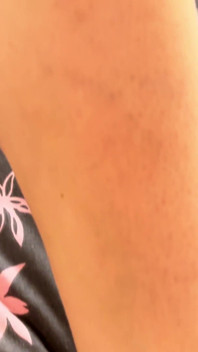 Amour De Soi Sensuel Dans De La Dentelle Noire