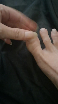 Lång tånagelklippning
