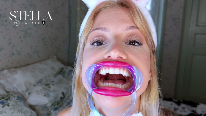 Stellafatale: Exame dos dentes da boca retrator