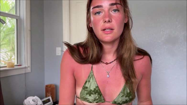 Alex Adams: Little Stepsister's Sunburn Accident - Arabella Rose - Family Therapy