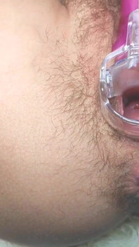 Una figa aperta usando un speculum_orgasm in primo piano durante