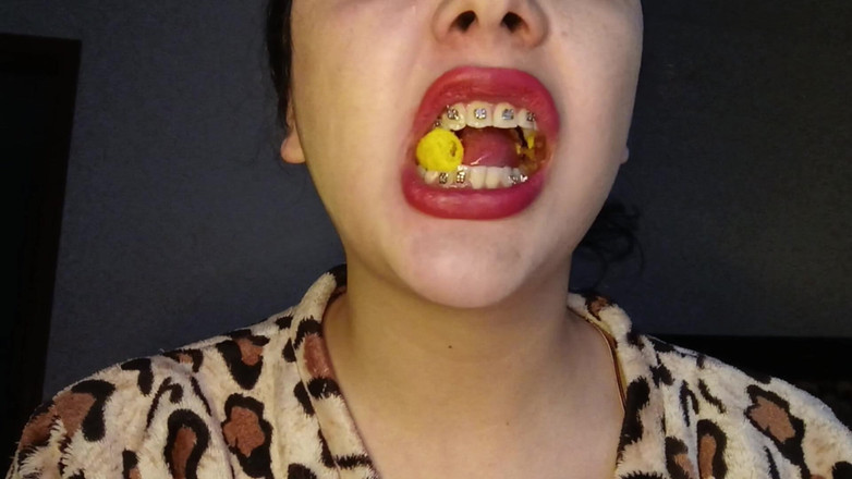 Golden domme: Chew cheetos देखने का बिंदु Uvula