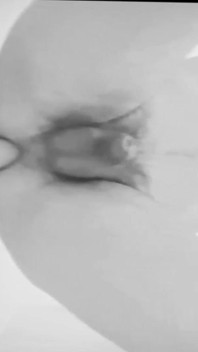 Anal Plaisure