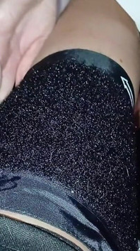 Zavolala jsem doktora do svého domu, který mě vyléčil Lízáním