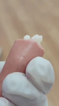 Harsh Penectomy for a Sexually Transmitted