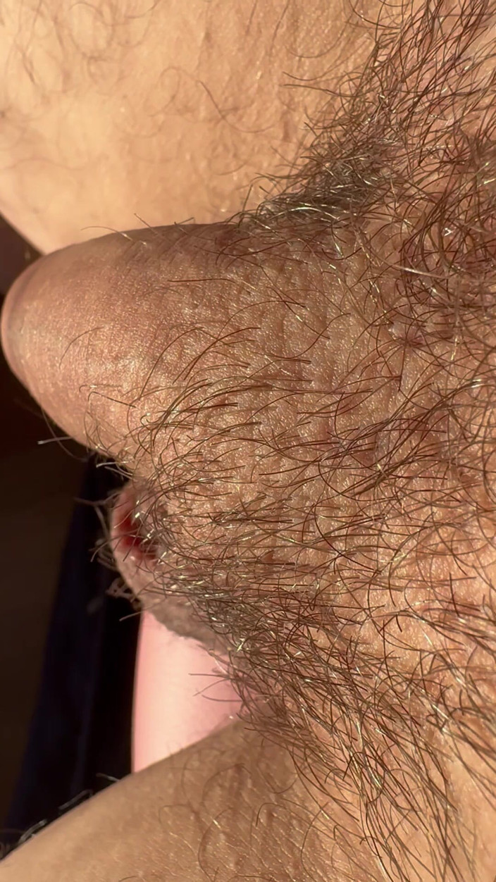 Nalekhome: Macro Wet Foreskin Dick