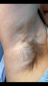 What Do You Think of My Hairy Armpits?