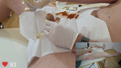 Clinical Climax: Kathetereinschub