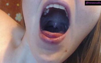 Inside My Mouth Sore Throat