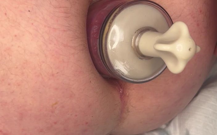 Ff couple xx: Anal-training mit meiner freundin