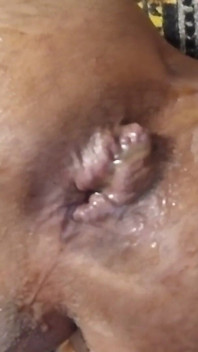 Part 2 Slow Gape