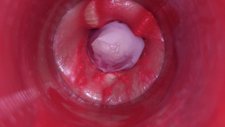 Ladybottox: Kamera dalam memek: memeknya dicrot sperma banyak bangek! Asmr Internal...