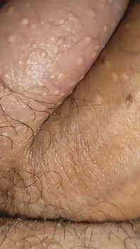Congelando mi polla con nitrógeno para tener una gran erección.