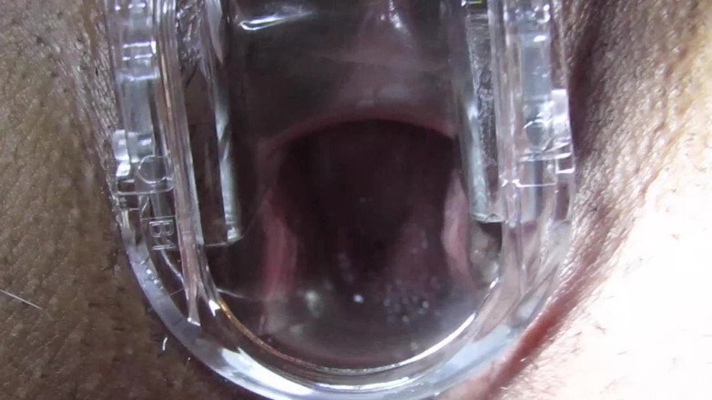 VeeVee Vixen: Cum Cervix Insemination
