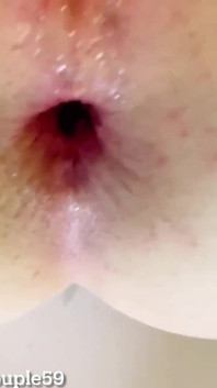 Anal yıkım, fışkırtana kadar götünü sikiyor, genç anal sikiş, aşırı anal sikiş, anal yumruk sokma, anal fışkırtma,