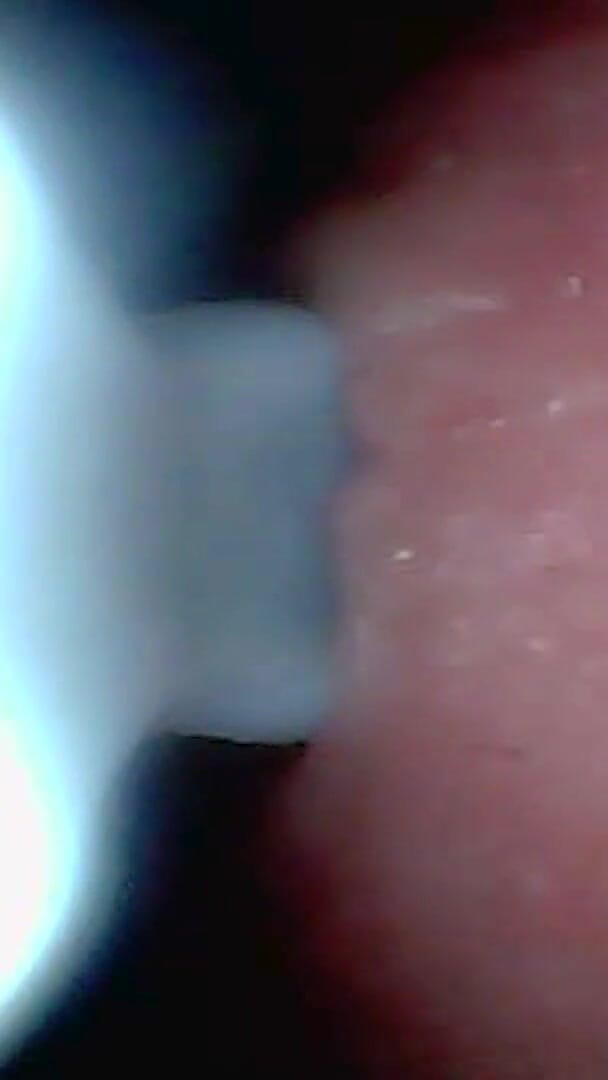 Ladybottox: Une Caméra Endoscopique Capture Un Moment D’éjaculation Masculine 4K