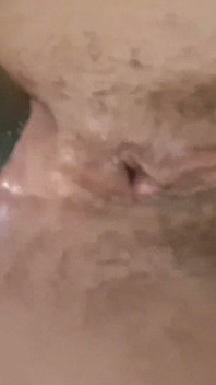 Dilation