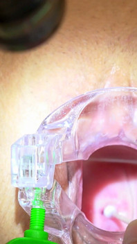 ตรวจหีของยายเซ็กซี่บนเก้าอี้ Gyno