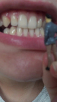 Moja przyrodnia siostra gigantka gra dentystę z małym przyrodnim bratem,