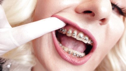 Arya Grander: ASMR视频：热辣牙箍和双层医疗护士氮化手套