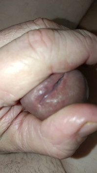 Is My Meatus Open?