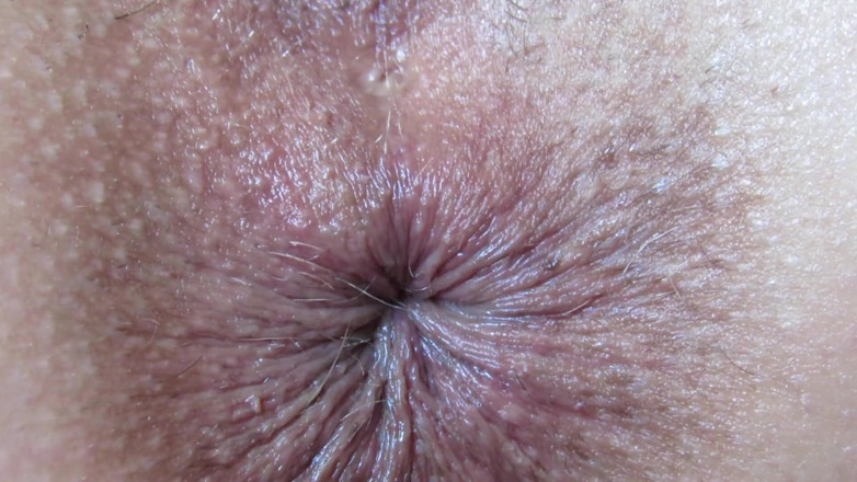 Cuteblonde666: ใกล้ชิดรูตูด เล่นรูตูดลึกๆ นิ้วยัดรูตูดเฟติช