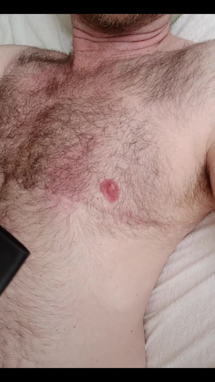 BonusholeToy: Ftm's boceta e mamilo punição 1