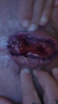 My Hole