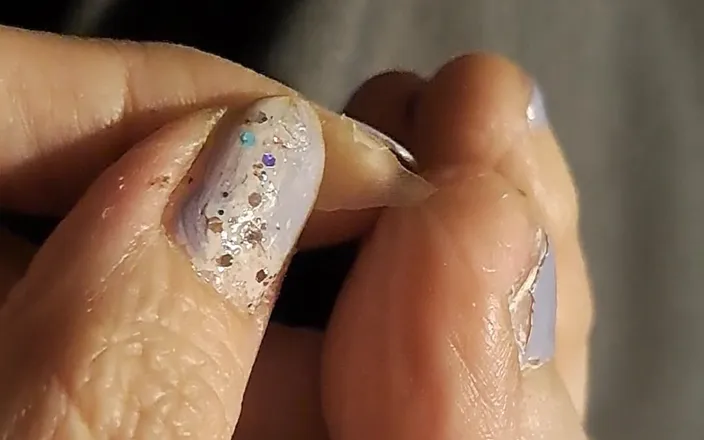 PandoraSG: Peeling a Huge Toe Skin Flake