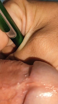 Application des chocs sur le pénis avec le stylo électrique.