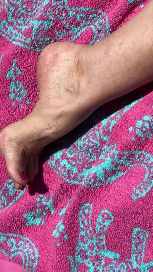 Aunt Ann: Fã pede avó nua ao sol mostra solas sujas e...