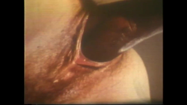 The Unforgettable: Raue Hände