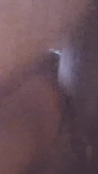 Nahaufnahme Anal