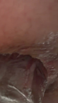Stretching Out My Hole