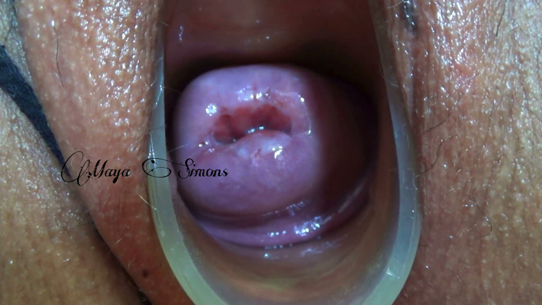 Maya Simons: This Is What My Cervix Looks Like After a Year...