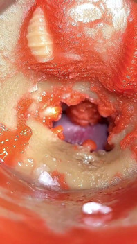Camera in Anal Cervix POV, Tiny Cucked by Giant ‘couple’, Cum in Anal and Creampie - Asmr