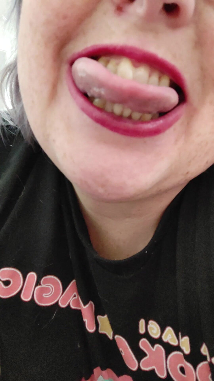AngYourDirtyCanadian: Close up of My Mouth and Tongue