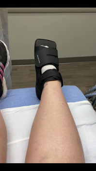 Welp, I messed up my foot